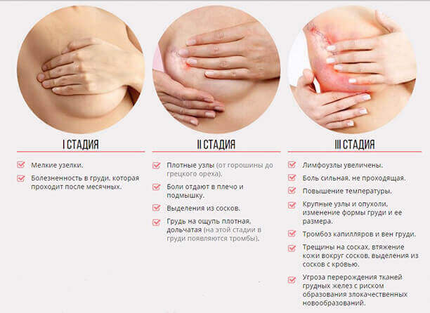 Ноет грудь