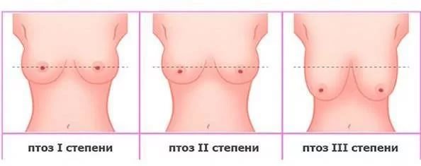 Маски для груди