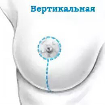 Вертикальный разрез