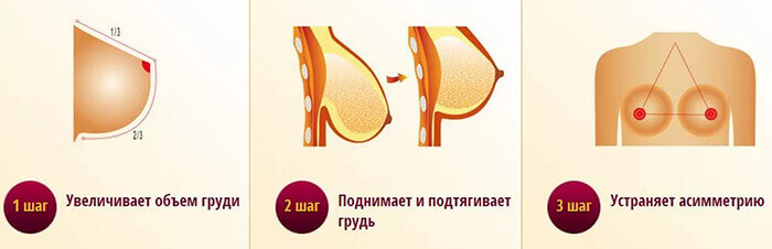Цены на операцию по подтяжке груди