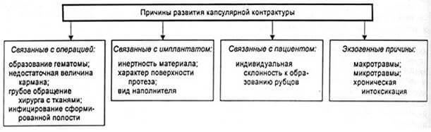 Капсулярная контрактура после маммопластики: симптомы, признаки, лечение