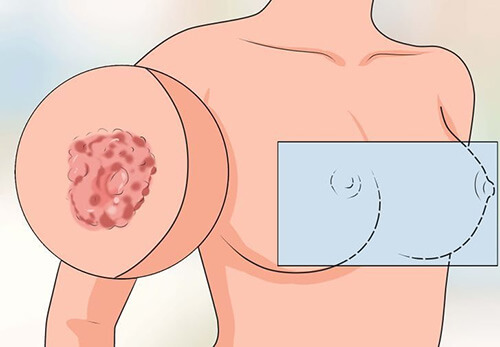 Грудь во время беременности