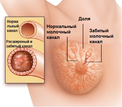 Колет в груди