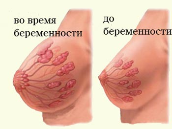 Набухание молочных желез при беременности
