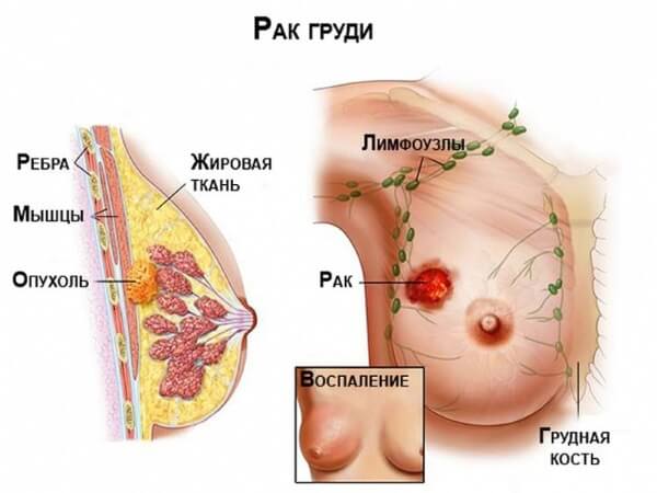 Обследование груди при беременности