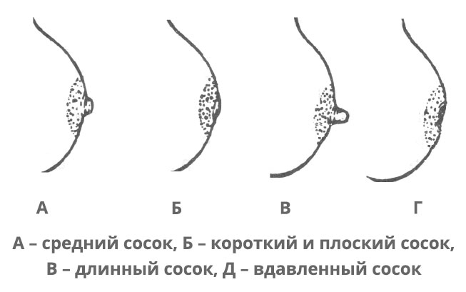впалые соски