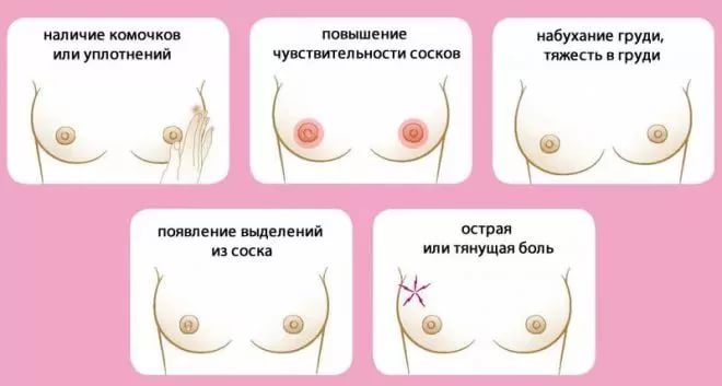 Как подготовить грудь к вскармливанию?